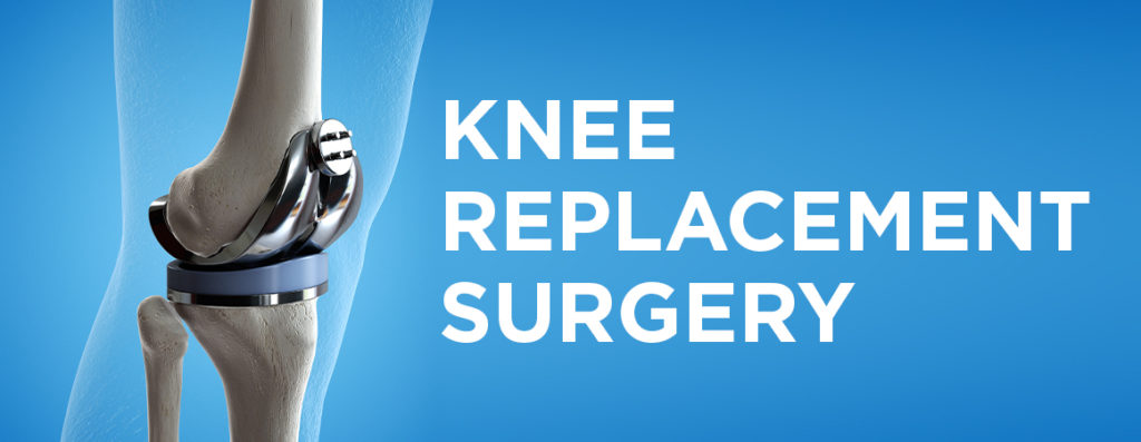 Knee Replacement Surgery Procedure Types And Risks Memon Medical Institute Hospital 2678