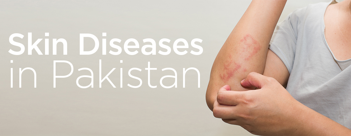Skin diseases in Pakistan