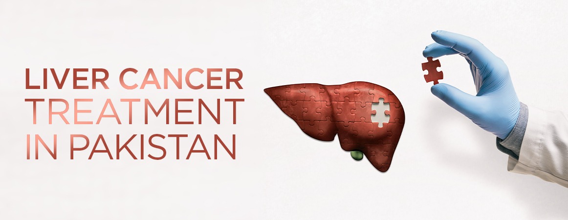 liver cancer treatment in Pakistan