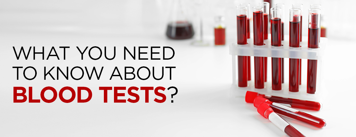 What you need to know about blood-test