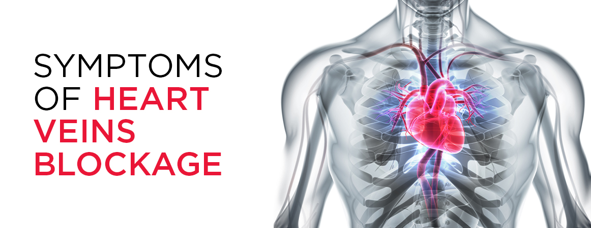 Symptoms of Heart Veins Blockage - MMI