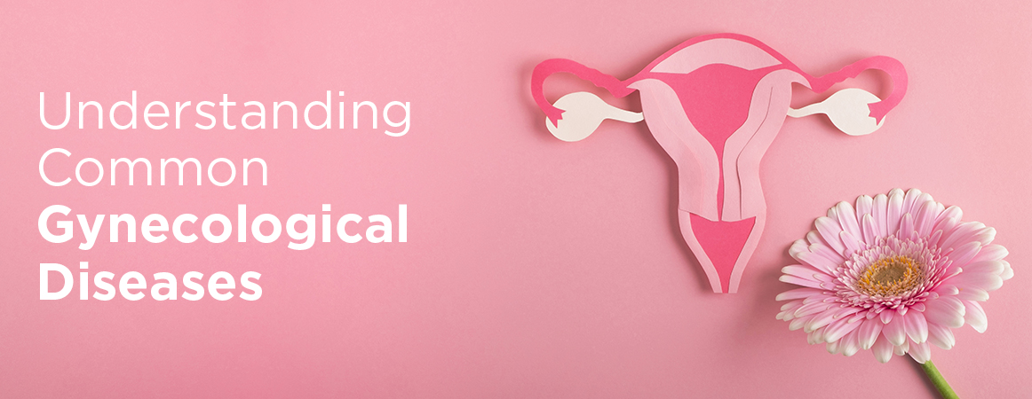 Understanding Common Gynecological Diseases