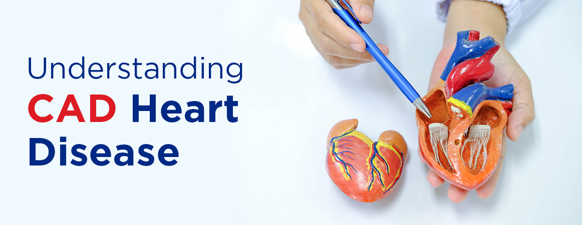 Understanding CAD Heart Disease