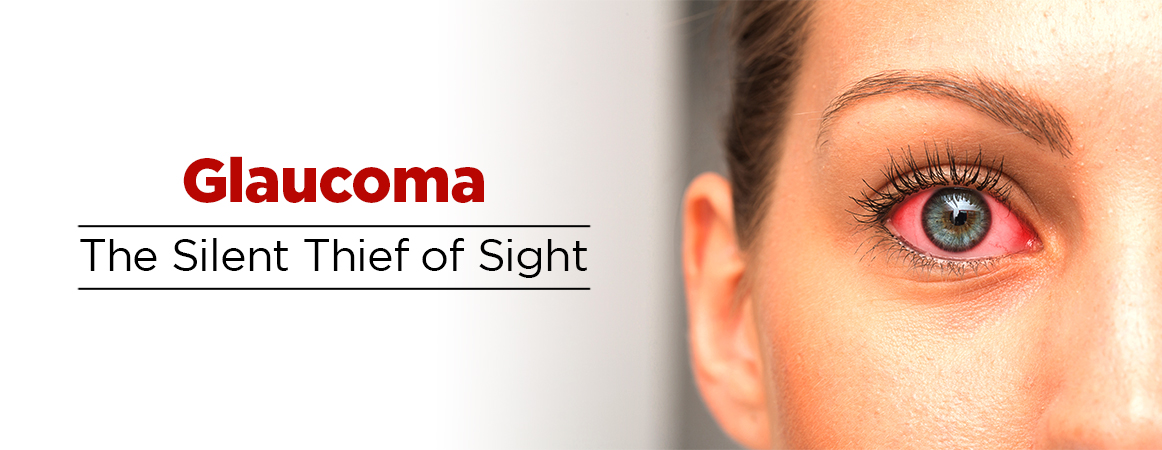 Glaucoma – The Silent Thief of Sight