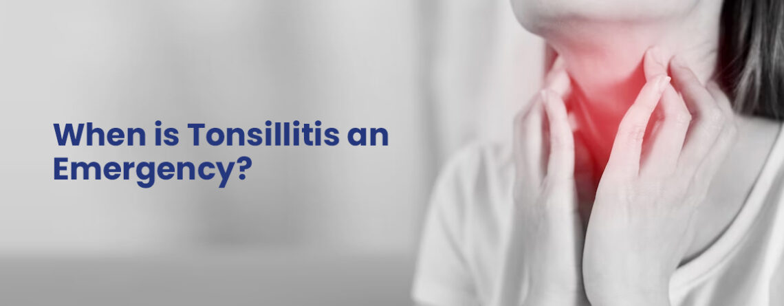 Know when tonsillitis is an emergency, how it causes breathing difficulty, high fever, dehydration, severe pain, or worsening symptoms. How long does tonsillitis last