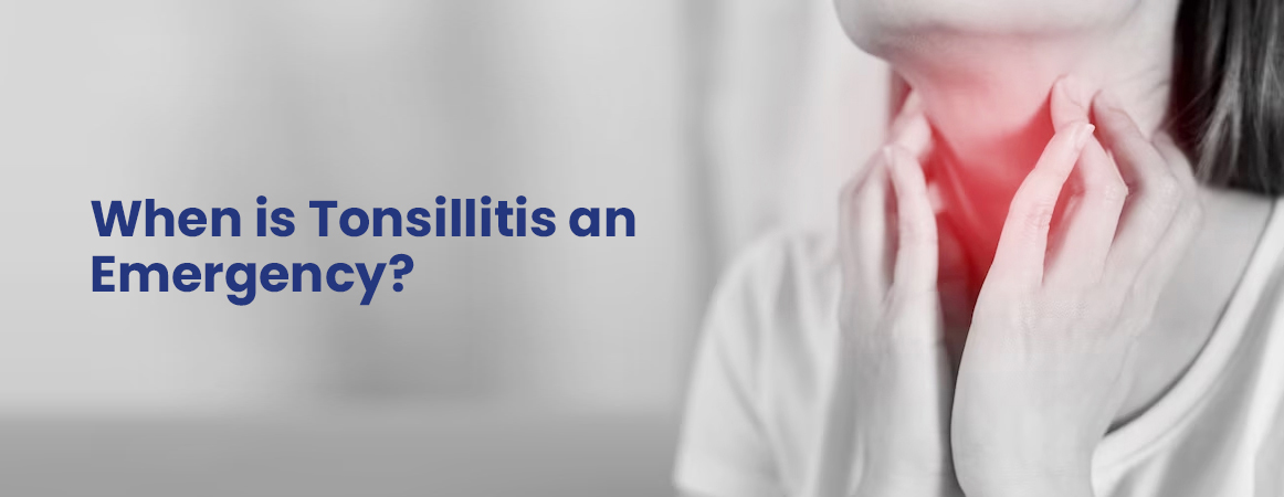 Know when tonsillitis is an emergency, how it causes breathing difficulty, high fever, dehydration, severe pain, or worsening symptoms. How long does tonsillitis last
